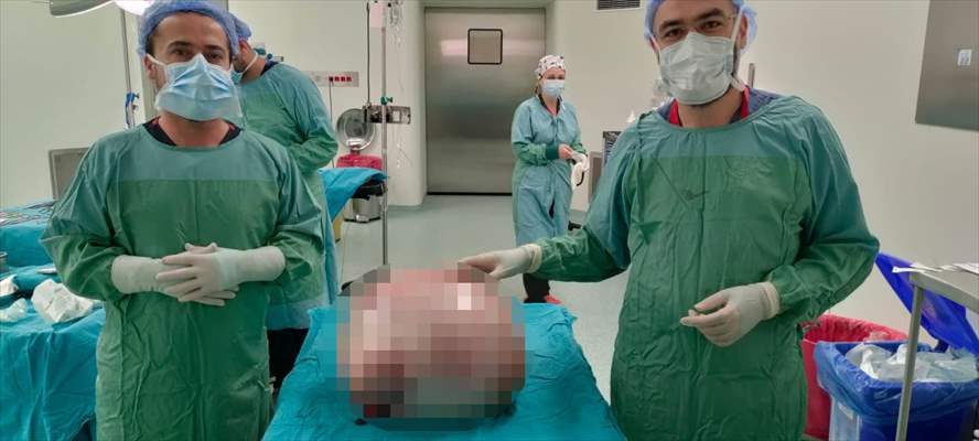 Tekirdağ'da Bir Hastanın Karnından 35 Kilogramlık Kitle Çıkarıldı