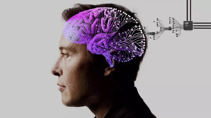 Elon Musk'ın Beyin Çipi Projesinin İnsan Deneyleri İçin Onay Aldığı Bildirildi